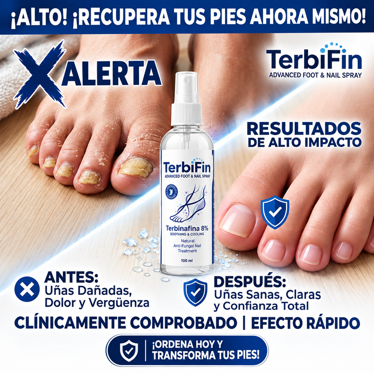 FungiStop™  Spray 8% Anti-Hongos Pies Uñas